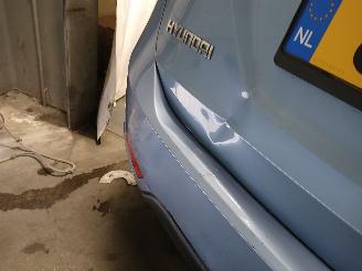 Hyundai Ix20 iX20 (JC) SUV 1.4i 16V (G4FA) [66kW]  (11-2010/07-2019) picture 29