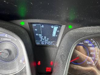 Hyundai Ix20 iX20 (JC) SUV 1.6i 16V (G4FC-G) [92kW]  (11-2010/07-2019) picture 2